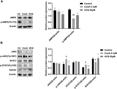 Hydroxychloroquine attenuates autoimmune hepatitis by suppressing the interaction of GRK2 with PI3K in T lymphocytes